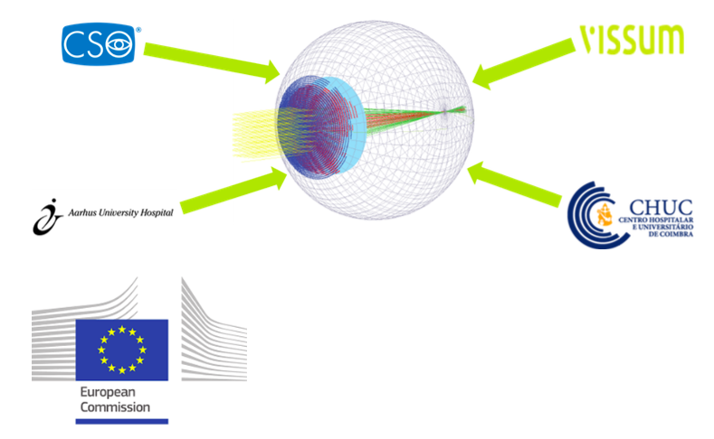 Ojo digital Vissum - Miranza